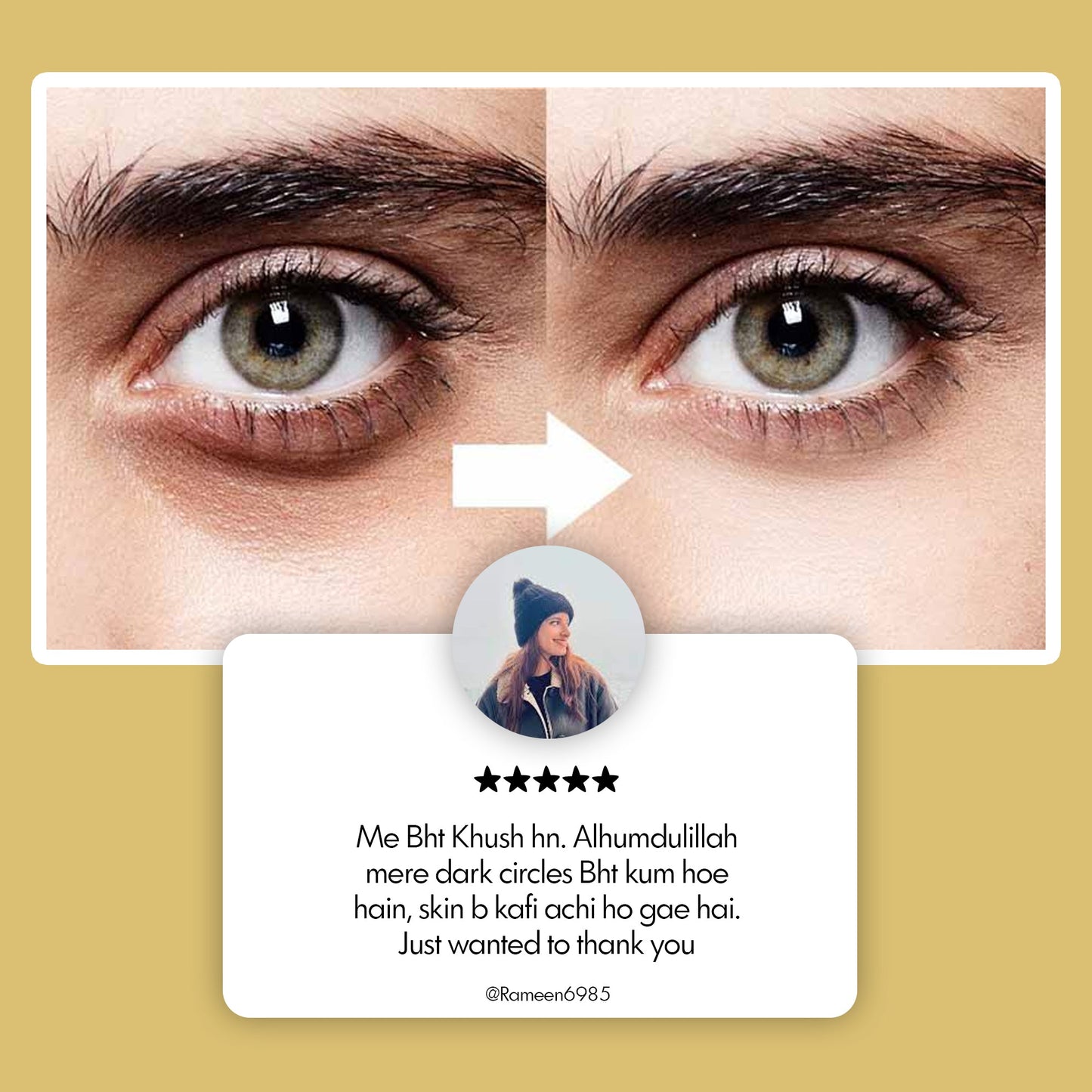 Under Eye Glory